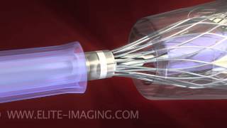 Heart Valve Catheter Loading  Medical amp Scientific Video Production [upl. by Rodie565]