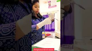 Blood smear preparation DC slide  Procedure of ideal blod smear [upl. by Elodea]