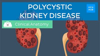 Polycystic kidney disease pathology symptoms diagnosis and treatment  Kenhub [upl. by Uriiah590]