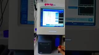 Cbc analyser machine test [upl. by Ainafets]