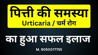 Skin Allergy  urticaria  पित्ती की समस्या  skin allergy treatment [upl. by Par]