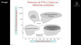 Hiperparatiroidismo primario [upl. by Petrine]