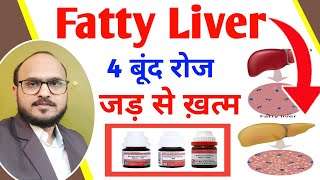 Fatty Liver Treatment Medicine  Chelidonium Majus for Liver  Fatty Liver Homeopathic Medicine [upl. by Marka732]