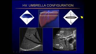 Ultrasound Abdominal pathology [upl. by Pucida]