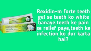 Rexidinm forte teeth gel review [upl. by Esiom]