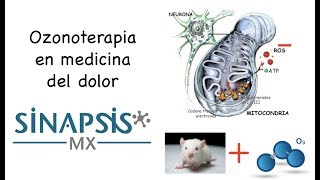 Ozonoterapia en medicina del dolor [upl. by Eseer299]