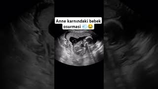 Farting of the baby in the 😂😂 Anne karnındaki bebeğin 😂😂 anne bebek shorts [upl. by Staal]