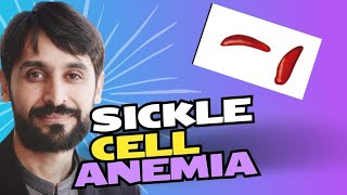 Sickle Cell Anemia  Causes  Symptoms  Diagnosis and Treatment  MLT Hub with kamran [upl. by Gardener]