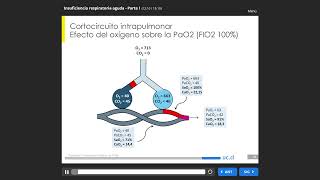 018 Insuficiencia Respiratoria Aguda [upl. by Annayoj]