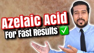 My Azelaic Acid Skincare Routine [upl. by Benjy]