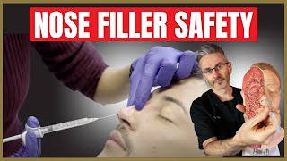 Nose Filler Safety  Liquid Rhinoplasty Injection Safety Advice [upl. by Boy]