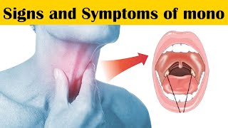 9 Signs and Symptoms of Mono Mononucleosis Symptoms [upl. by Bodi]