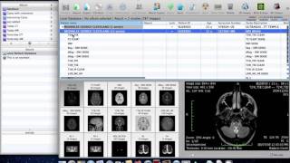 Viewing SRG images with OsiriX on Mac [upl. by Letnoj]