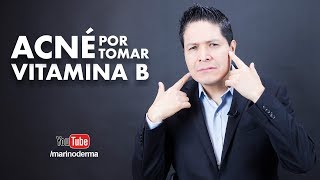 ¿La vitamina B produce acné  Dr Marino dermatólogo [upl. by Enois616]