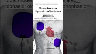 Monophasic vs biphasic defibrillators [upl. by Areek]