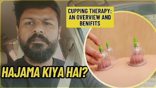 Hijama Kiya Hai Cupping Therapy Cure To Every Disease Benefits Of Hijama Cupping Therapy [upl. by Terra115]