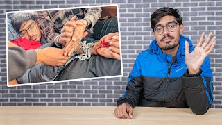 मुझे सांप ने कैसे काटा How Cobra Snake Bite Happened [upl. by Stronski]