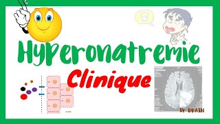 Hypernatrémie signes cliniques [upl. by Arv]