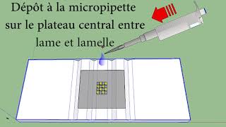 Tuto Lame de Malassez mini aquarium pour suspension cellulaire SVT Hervé Kempf lycée de lElorn [upl. by Leemaj189]