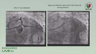 Cutting Scoring amp OPN by Prof Dhiman Banik [upl. by Borchers262]