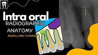 Normal radiographic anatomical landmarks  Intra Oral Anatomy  Maxilla Canine [upl. by Nnaerb]