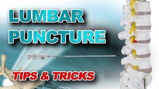 Lumbar Puncture Tips amp Tricks [upl. by Sirej]