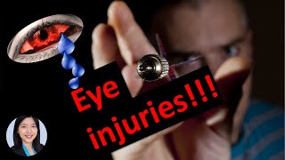 Eye injuries dont get hurt by your loved ones [upl. by Blackburn]