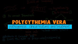 Polycythemia Vera Made Easy  WBC disorders  Usmle Hematology [upl. by Eetnahs895]