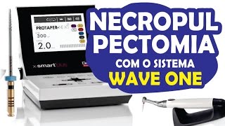 Necropulpectomia em sessão única em canino superior com WaveOne [upl. by Lirba]