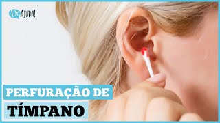 PERFUREI O TÍMPANO O QUE FAZER E COMO PREVENIR [upl. by Enorahs]