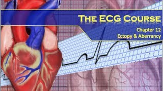 The ECG Course  Ectopy amp Aberrancy [upl. by Hamlani412]