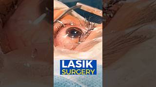 Live Lasik Surgery [upl. by Berty]