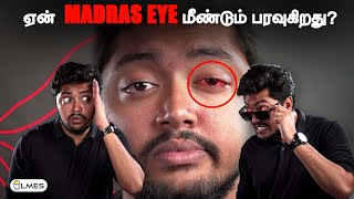 Why Madras Eye is spreading FASTER  மெட்ராஸ் ஐ  LMES  Conjuctivitis Adenovirus Virusmutation [upl. by Mcnelly]