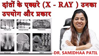 Dental xRay Types  दांतों के एक्सरे X  Ray  उनका उपयोग और प्रकार  Dental Clinic  HeathFirst [upl. by Ansel747]