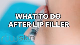 💋 Lip Filler Aftercare ​rtwskincouk [upl. by Inaja]