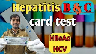 Hepatitis B and C detection by rapid card test  HBsAg and HCV detection by rapid card test [upl. by Ellerey557]