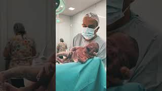 Newborn baby after birth 😘😘😘 shorts viralvideo trending [upl. by Busiek]