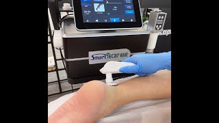 Smart Tecar Wave  Tecar with Radial Shockwave with EMS Therepy 3 in 1  KAPHAPHYSIO [upl. by Yevette745]