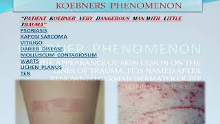 KOEBNER PHENOMENON MNEMONIC DERMATOLOGY [upl. by Okin]