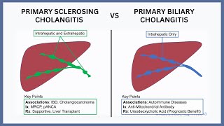 Primary Biliary Cholangitis vs Primary Sclerosing Cholangitis [upl. by Ahsercal]