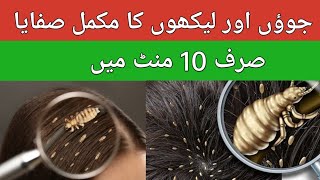 how to remove head lice in 10 minute  sar ki juen khatam Kane ka tarika [upl. by Lebiralc381]