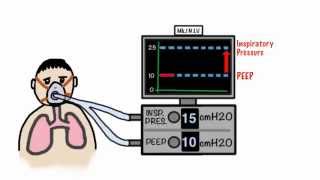 CPAP and NonInvasive Ventilation in 5 minutes [upl. by Boorer]