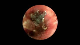 Ear Mites Inside Dog’s Ear Canal Video Otoscopy [upl. by Erdnua856]