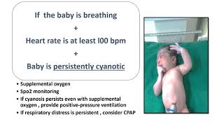 Neonatal Resuscitation Part3  2020 AAP Guidelines  Positive Pressure Ventilation StepB [upl. by Pardo]