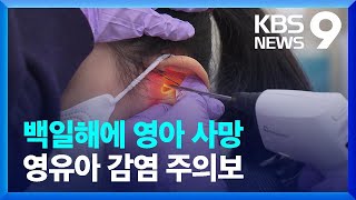 생후 두 달 안된 영아 백일해 사망…2011년 집계 이래 처음 9시 뉴스  KBS 20241112 [upl. by Aaberg]