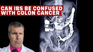 IBS vs Colon Cancer Understanding the Differences and Similarities [upl. by Tteraj623]