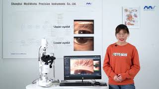 MediWorks Dry Eye Diagnostic System introductionEyelid Edge ampEye Redness Checking Function [upl. by Chemar322]