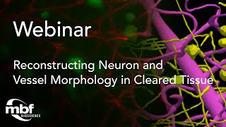 Webinar Reconstructing Neuron and Vessel Morphology in Cleared Tissue [upl. by Onirefes387]