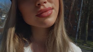 Botox lip flip stuff you have to know lip filler בוטוקס בשפתיים [upl. by Key]