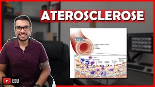 COMO OCORRE A ATEROSCLEROSE Cardio 20 [upl. by Smaoht]